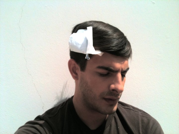 TAO FERNANDEZ CAINO