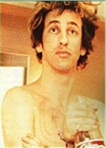 Hillel Slovak