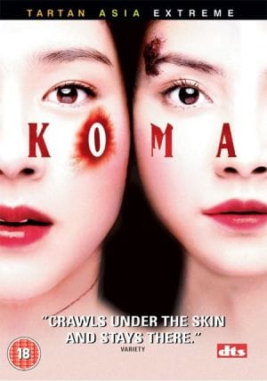 Koma