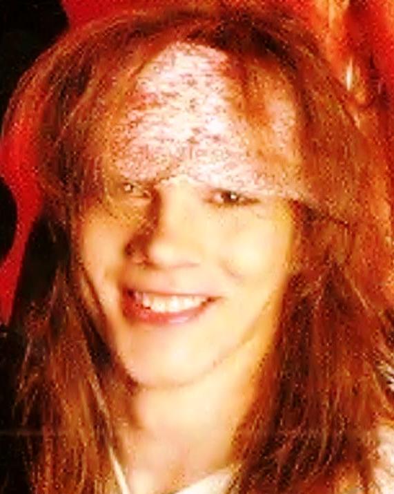 Axl Rose