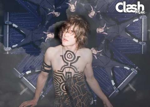 MGMT
