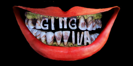 Gingiva