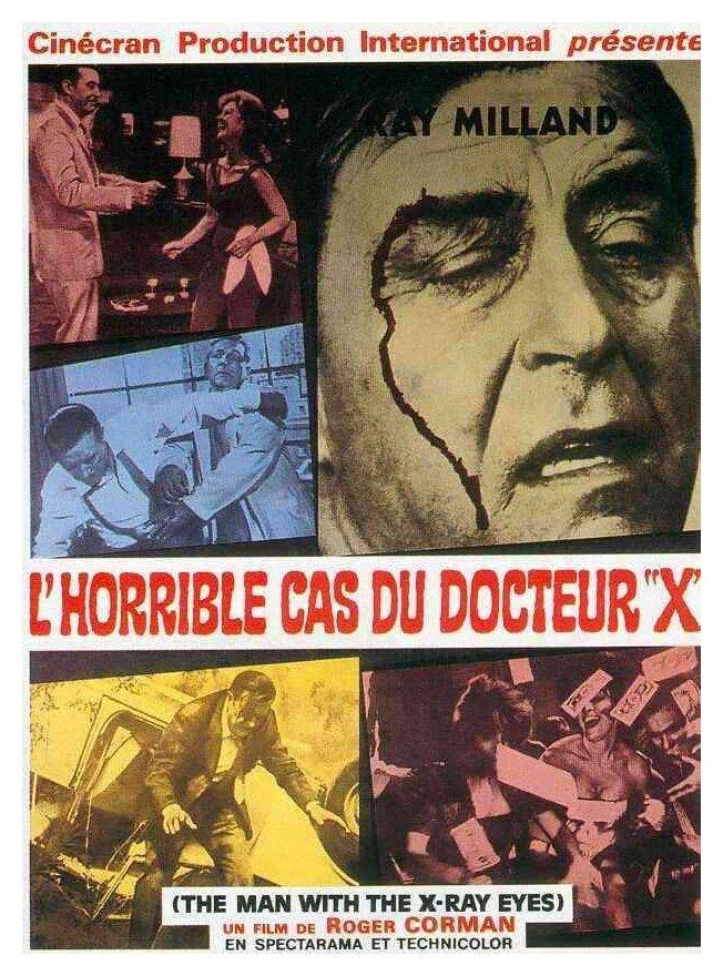 X: The Man with the X-Ray Eyes (1963) X: The Man with the X-Ray Eyes (1963)