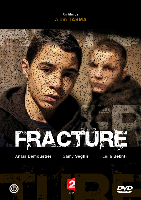 Fracture image
