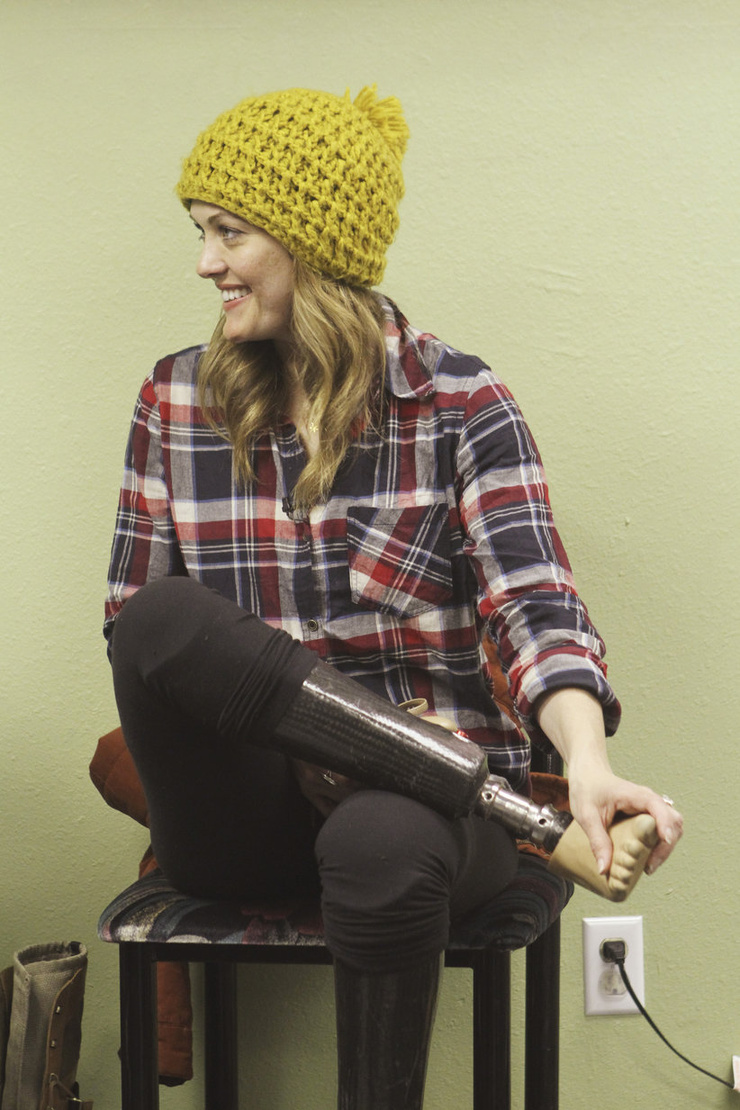 Amy Purdy