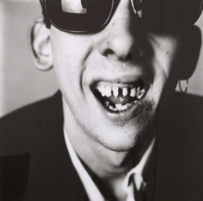 Shane MacGowan