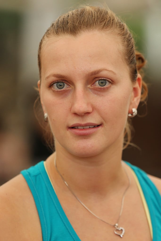 Petra Kvitova Petra Kvitova
