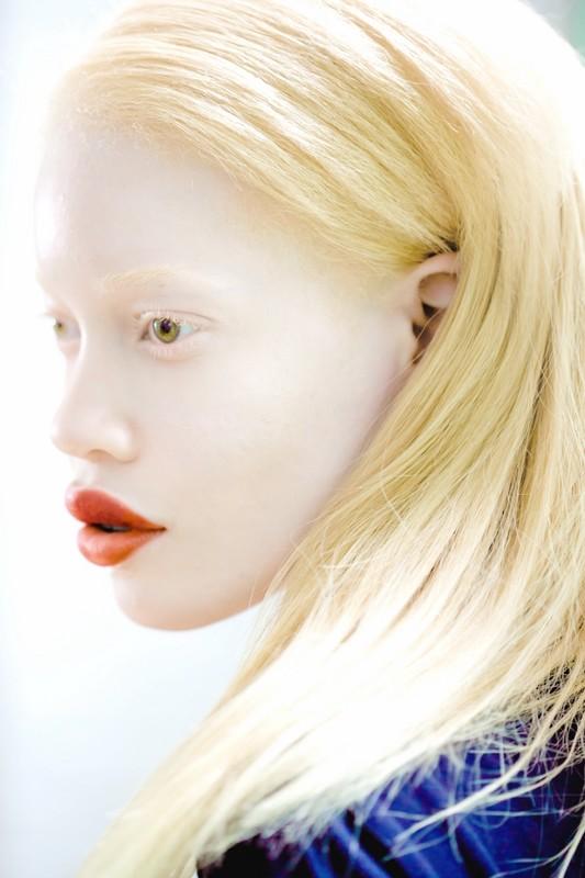 Diandra Forrest