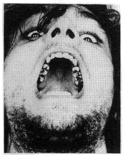 Syd Barrett Syd Barrett
