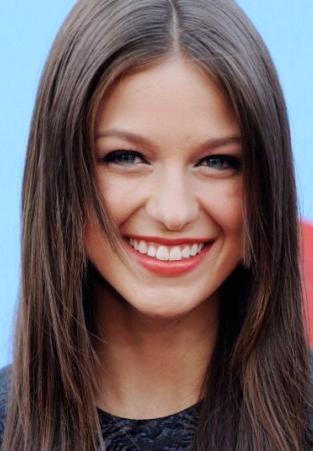 Melissa Benoist Melissa Benoist