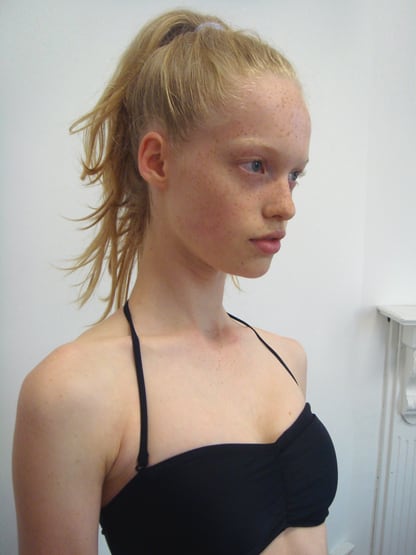 Lilly Stent