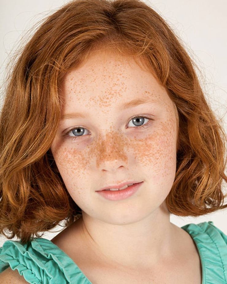 Are redheads with blue eyes really going extinct?